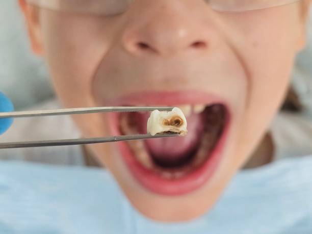 Best Pediatric Emergency Dentist in Glassport, PA